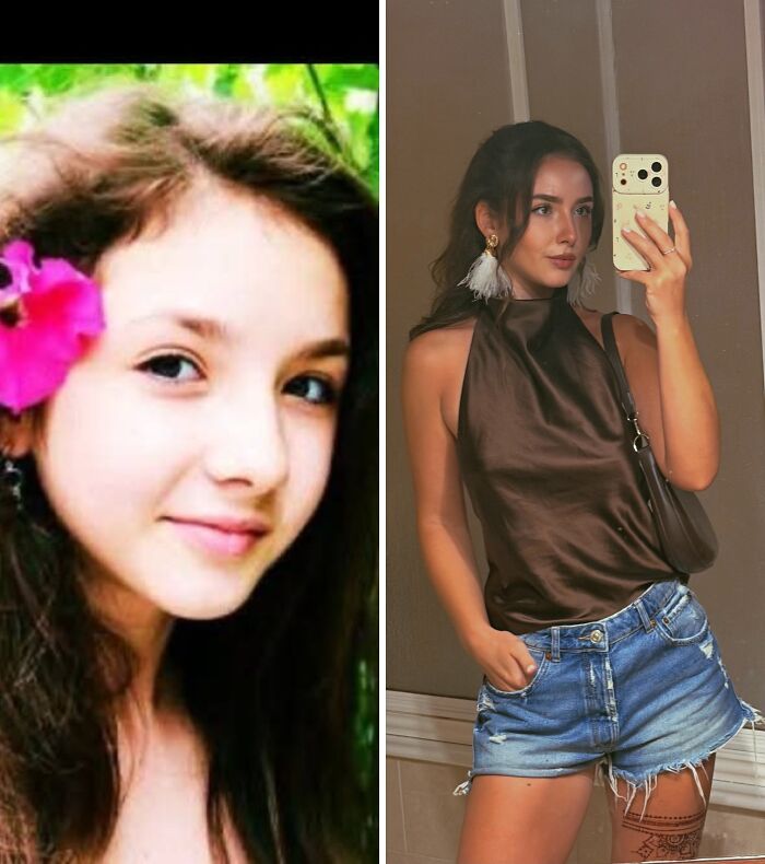 Wait Till You See These Epic ‘Ugly Duckling’ Glow-Ups!