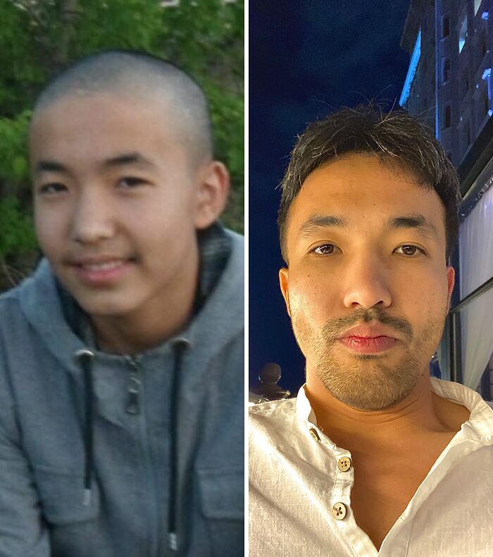 Wait Till You See These Epic ‘Ugly Duckling’ Glow-Ups!