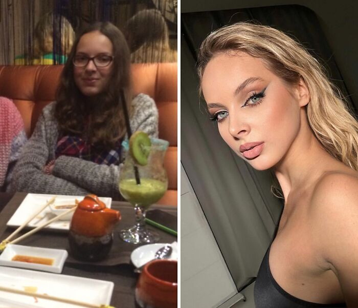 Wait Till You See These Epic ‘Ugly Duckling’ Glow-Ups!
