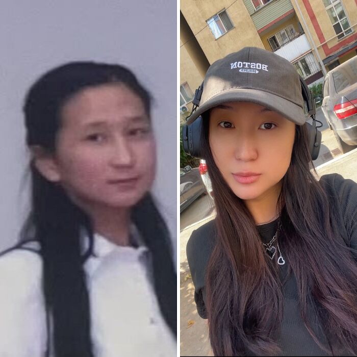 Wait Till You See These Epic ‘Ugly Duckling’ Glow-Ups!