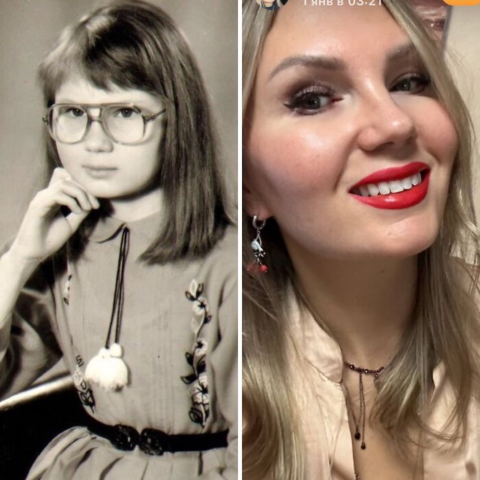 Wait Till You See These Epic ‘Ugly Duckling’ Glow-Ups!