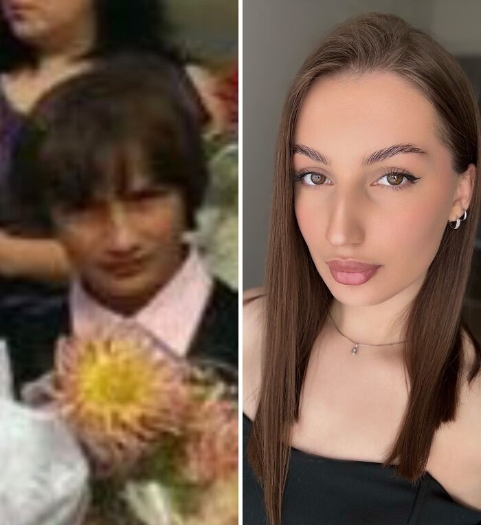 Wait Till You See These Epic ‘Ugly Duckling’ Glow-Ups!