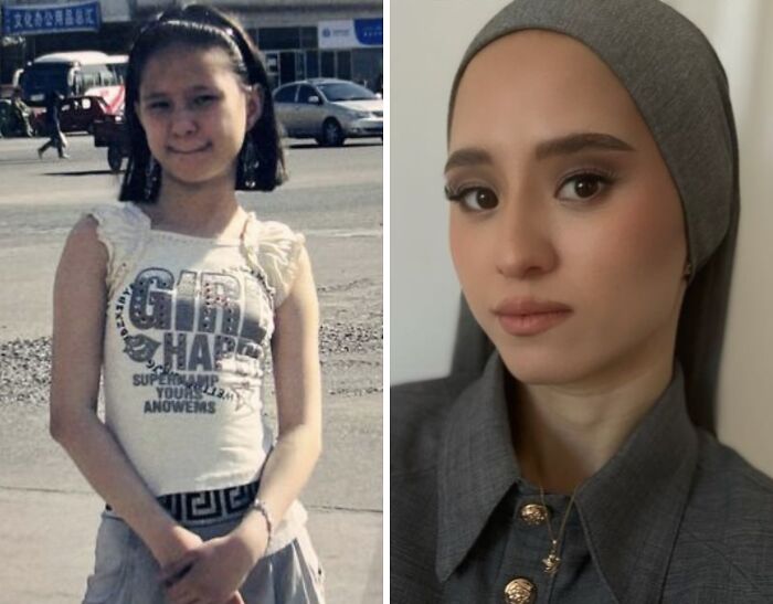 Wait Till You See These Epic ‘Ugly Duckling’ Glow-Ups!