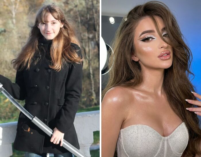 Wait Till You See These Epic ‘Ugly Duckling’ Glow-Ups!