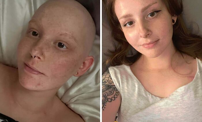 Two Years Later & She’s Cancer-Free!