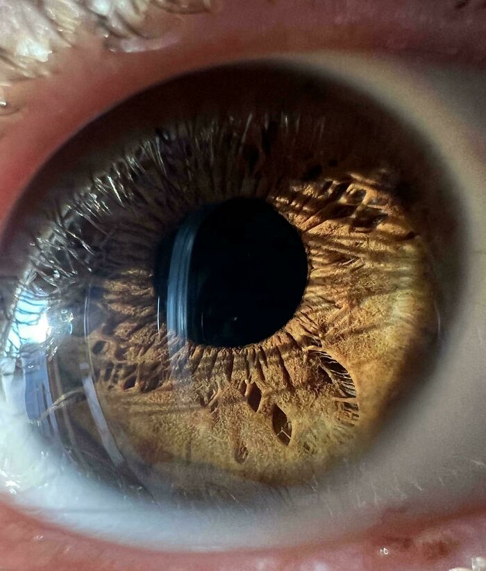 A Feather-Like Pattern? Yep, In My Iris!
