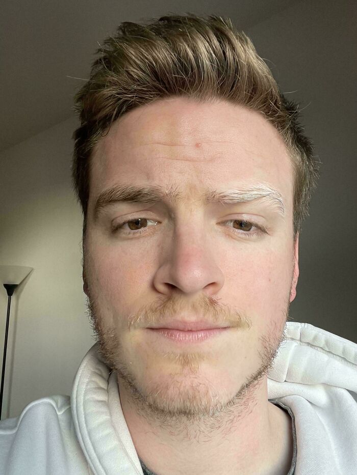 Suddenly Turning White...Eyebrow Drama!