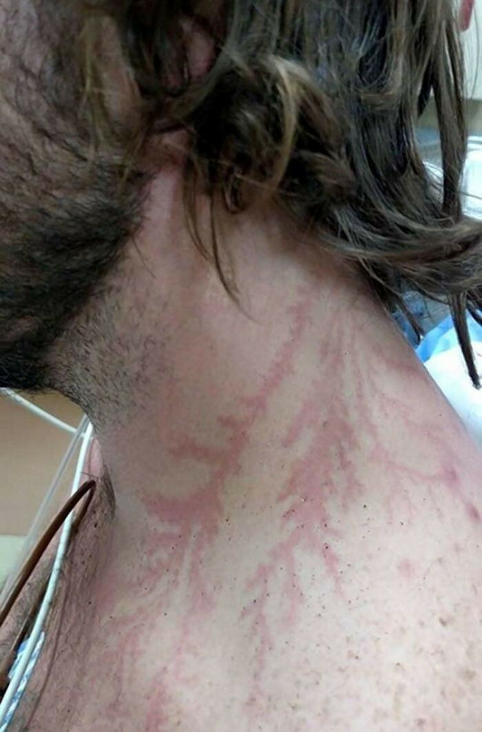 Struck by Lightning and Got a Nature Tattoo!