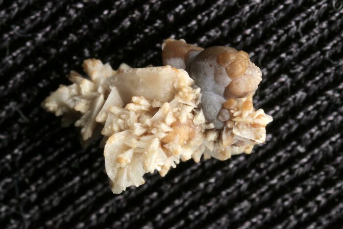 Say Hello to This Wild Kidney Stone