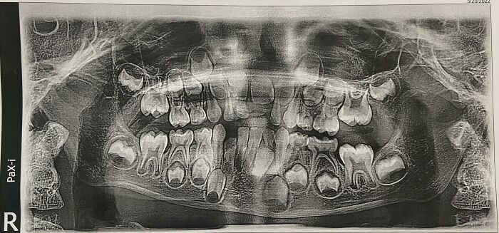My 6-Year-Old’s Dental X-Ray is a Mini Adventure