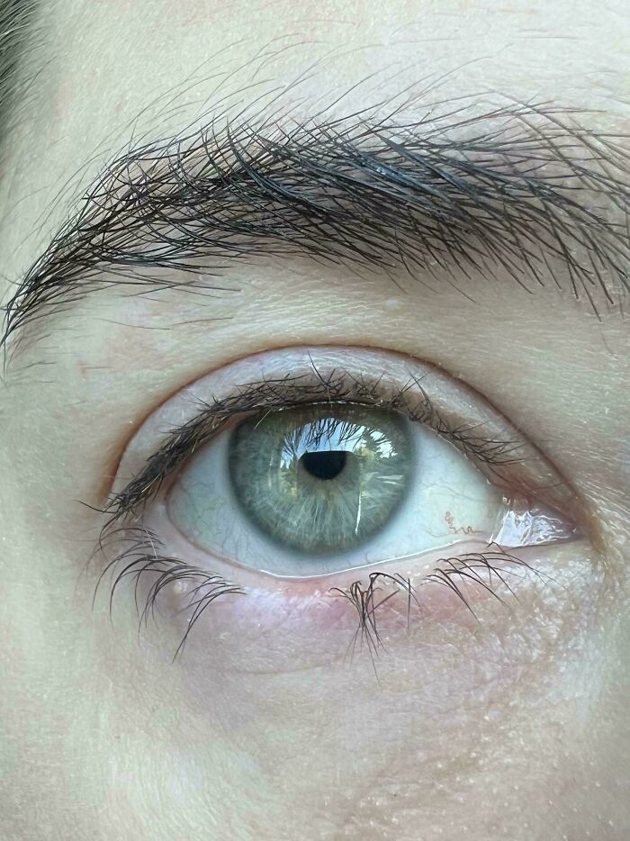 Bottom Eyelashes Missing in the Middle? That’s Me!