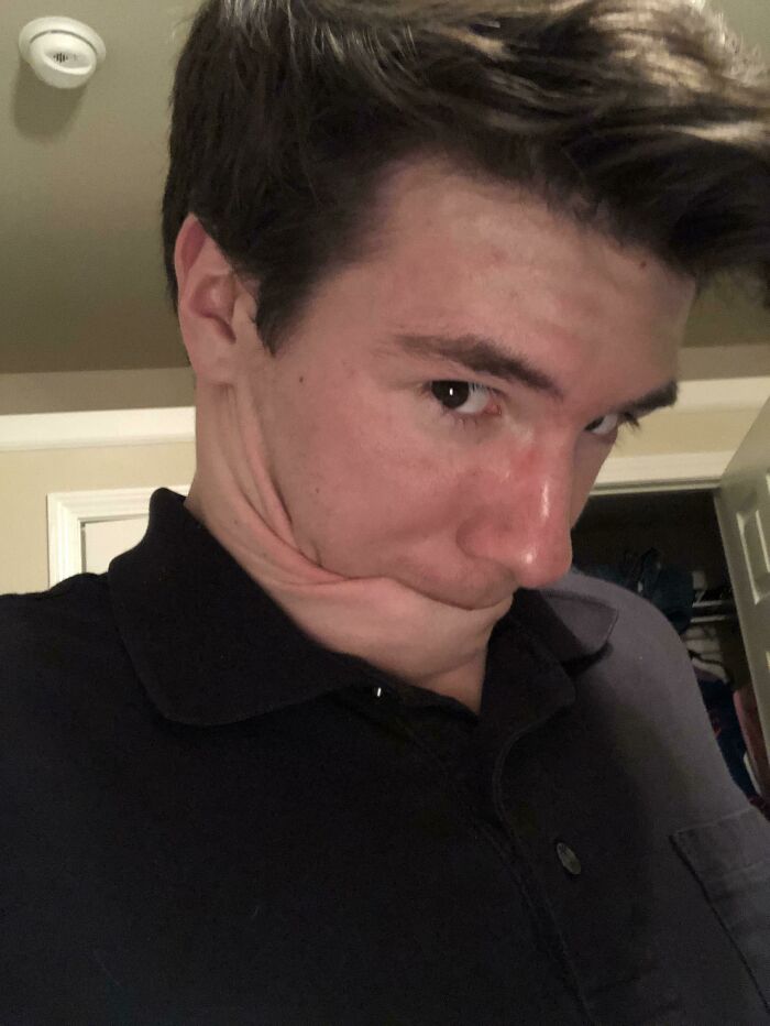 My Neck Skin Stretches So I Suck On It Without Hands!