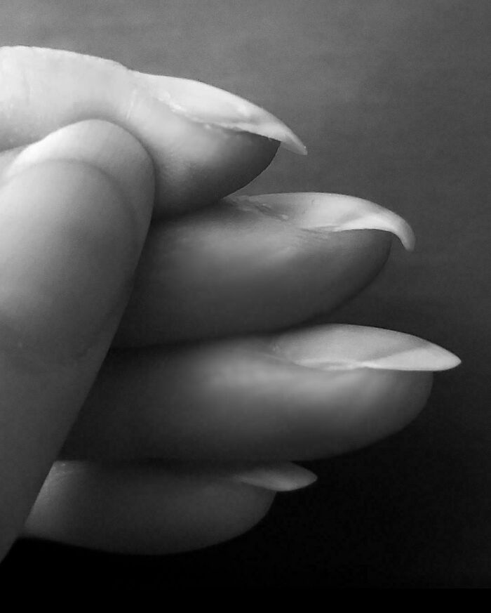 My Middle Finger Nails Curl Way More Than the Others