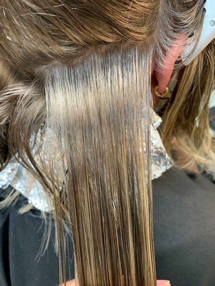 Hair Color Changed 3 Times in a Month Thanks to Autoimmune Disorder