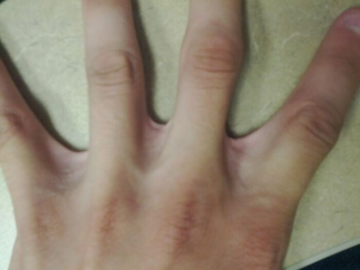 Extra Webbing Between My Fingers!