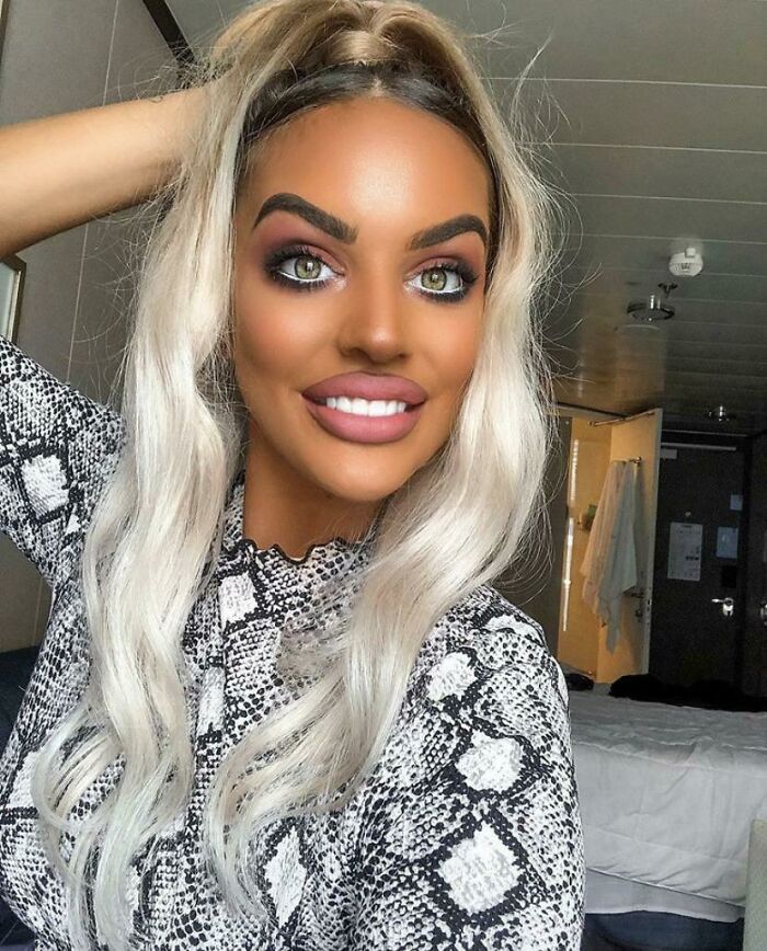 She’s A Full 8 Shades Darker Than Her Arm!