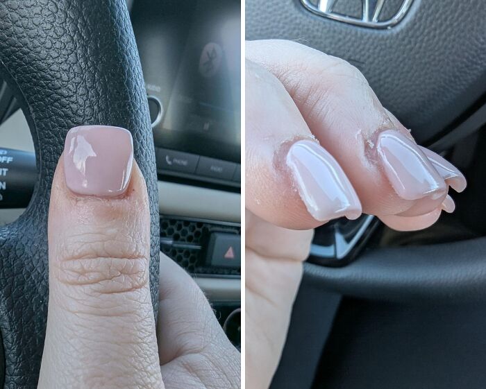 Turned My Thumbs Into Toes for $80!