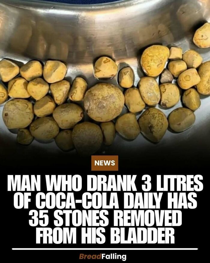 Wait, They Actually Rank This?! 63 Mind-Blowing Facts That’ll Totally Blow Your Mind