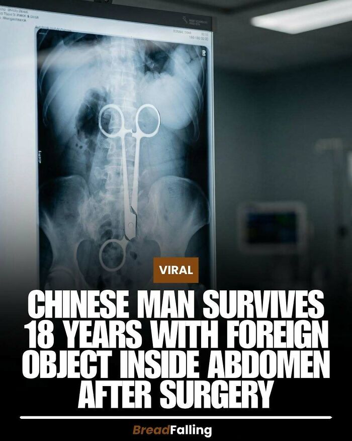 Wait, They Actually Rank This?! 63 Mind-Blowing Facts That’ll Totally Blow Your Mind