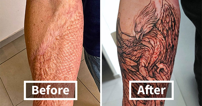 Wait Till You See These 30 Jaw-Dropping Scar Tattoos That Totally Flip The Script!