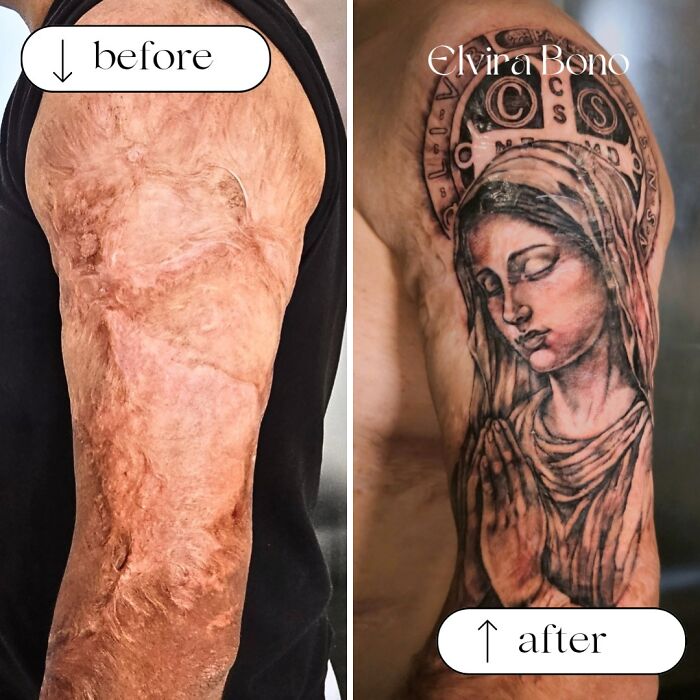 When Childhood Burn Scars Get A Tattoo Glow-Up