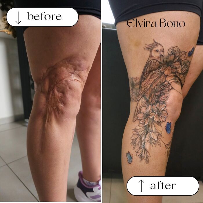 Traffic Accident Scar? Time For Some Tattoo Magic!