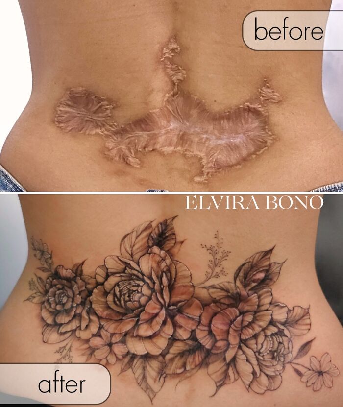 Plastic Surgery Scars Go From Oops To Opus