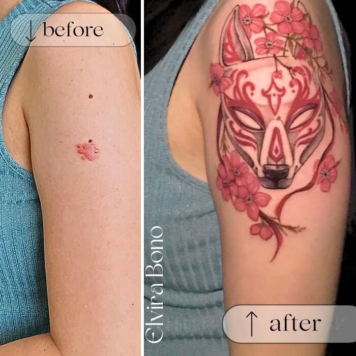 Birthmark Scar? Tattoo Time, Baby!
