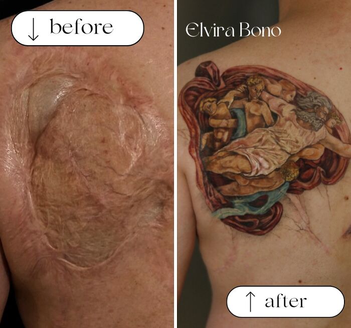 Deep Back Scar? Say Hello To Incredible Tattooing