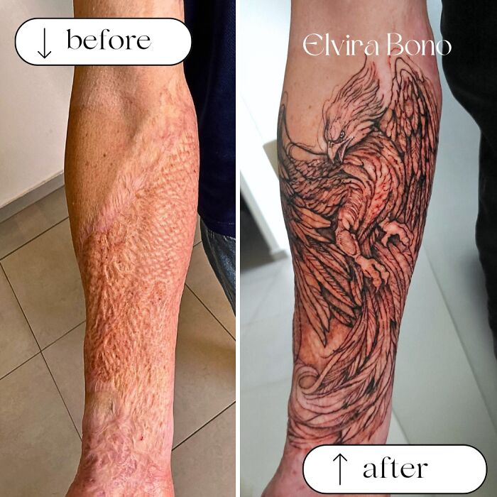 Traffic Accident Graft Burn Scar Tattoo Glow-Up