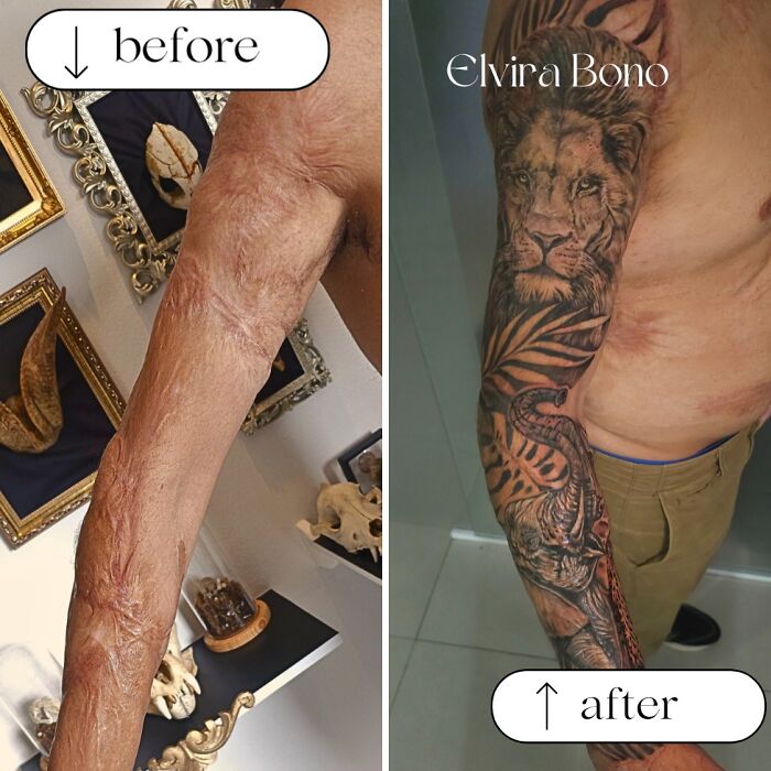 Childhood Burn Scar Gets The Ultimate Tattoo Glow-Up