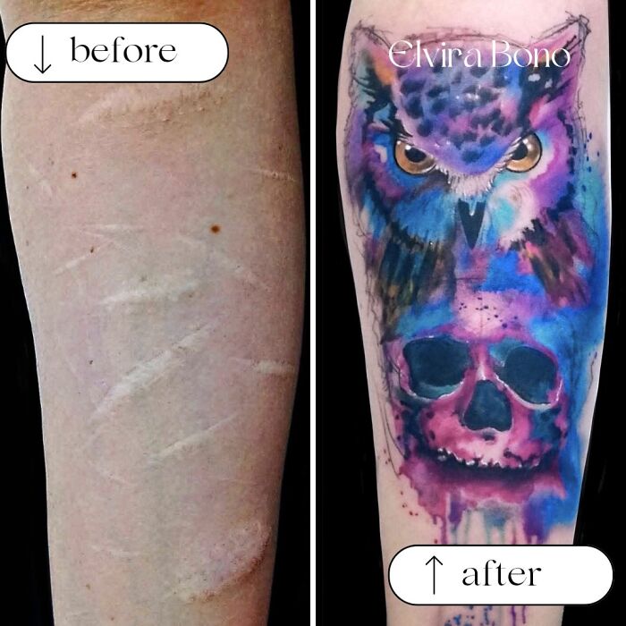 Self-Harm Scars? Watch The Tattoo Magic Happen