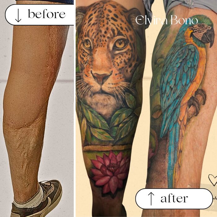 Burn Scar With Graft? Tattoo Transformation Alert