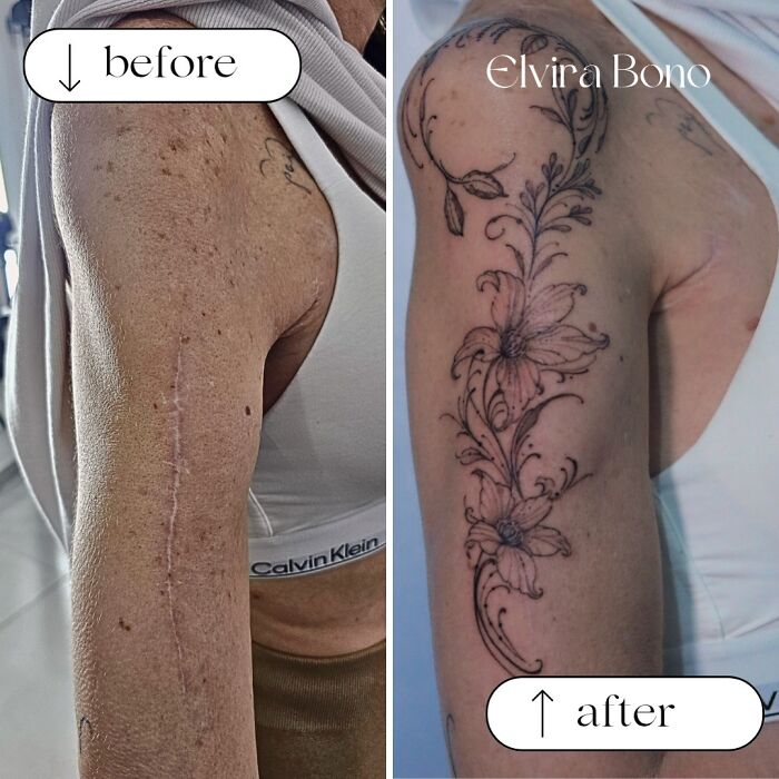 Traffic Accident Scar Gets Tattoo Coolness
