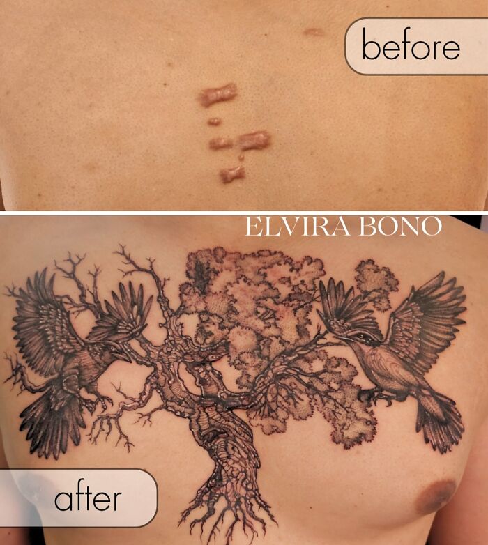 Tattoo Love For Keloid Scars All Around