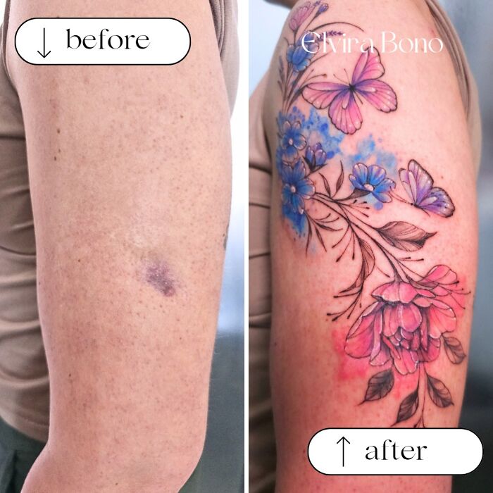 Domestic Accident Scar? Watch The Tattoo Magic
