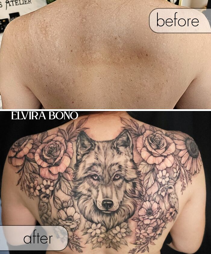 Second Round Tattoo On Acne Scars - Because Why Not?