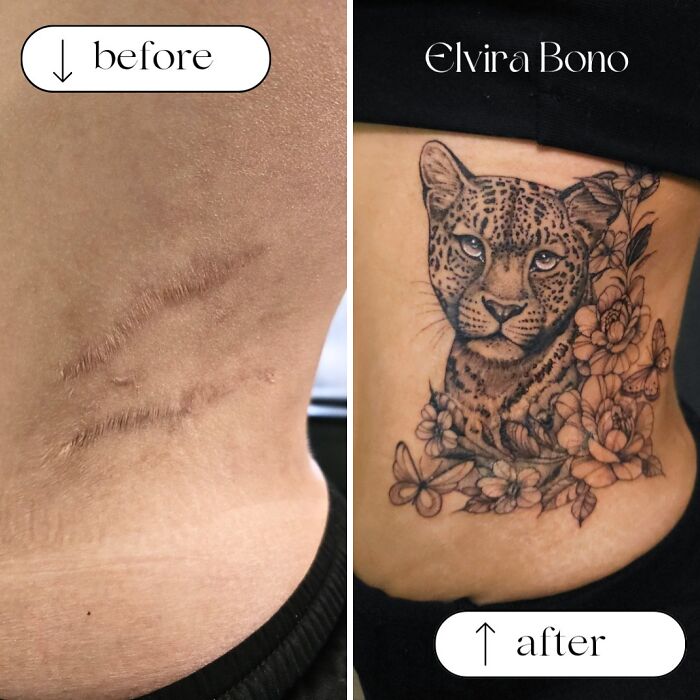 Surgical Scars? There's A Tattoo For That!