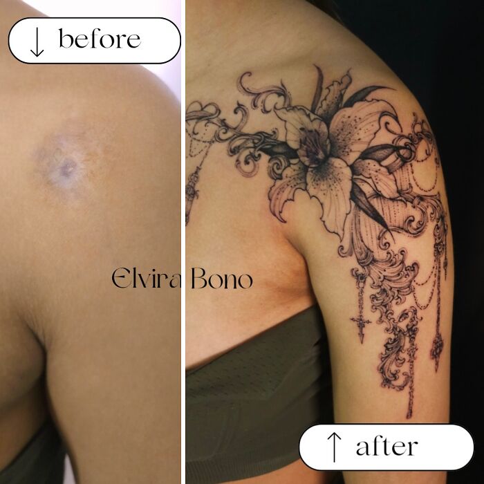 Bicycle Accident Scar Flip With Tattoo Power