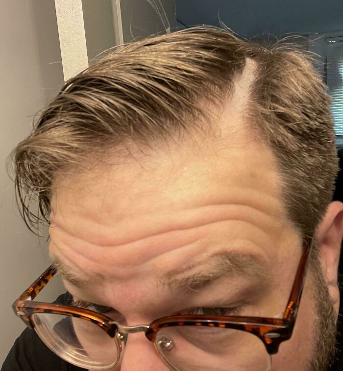 Asked for My Part Cut In, Got a Half-Inch Stripe Shaved Out Instead!