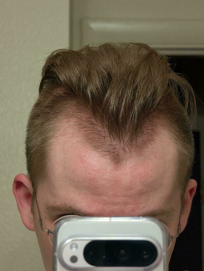 Wait, They Actually Did *This* Haircut?! The Funniest Salon Fails Ever