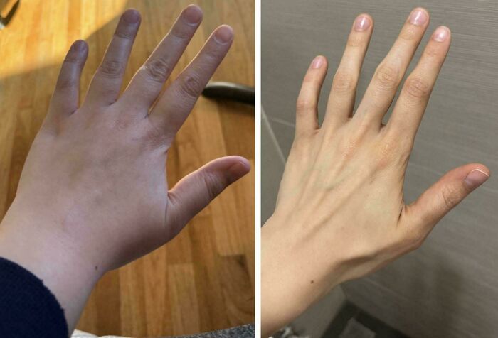 These Before & After Pics Will Blow Your Mind (And Make You Wanna Cheer!)