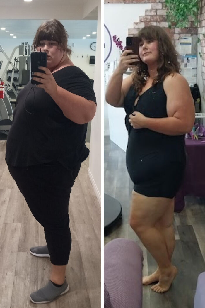 These Before & After Pics Will Blow Your Mind (And Make You Wanna Cheer!)