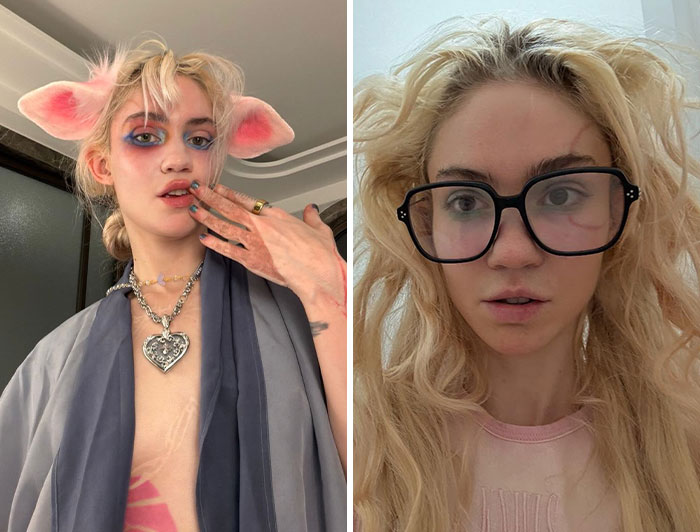 Grimes: Diagnosed at 37 and Still Rocking It
