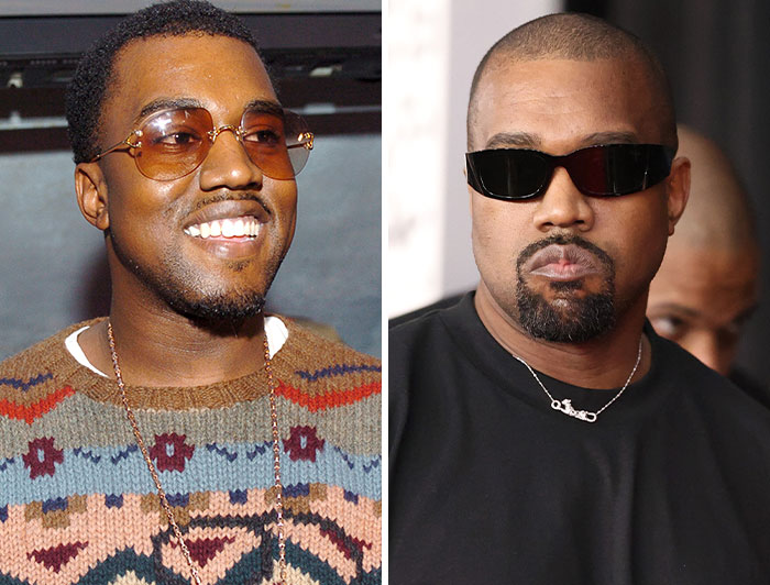 Kanye West: From Bipolar to Autism Diagnosis