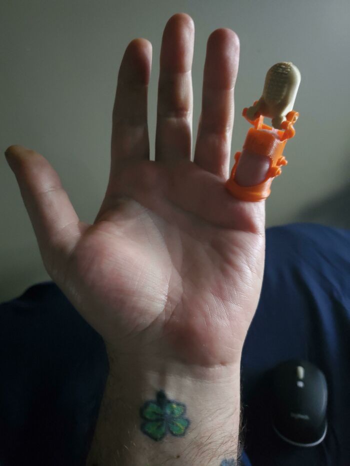 My Friend Built Me a New Finger After Insurance Said 'No Way.' High Five to Friendship!