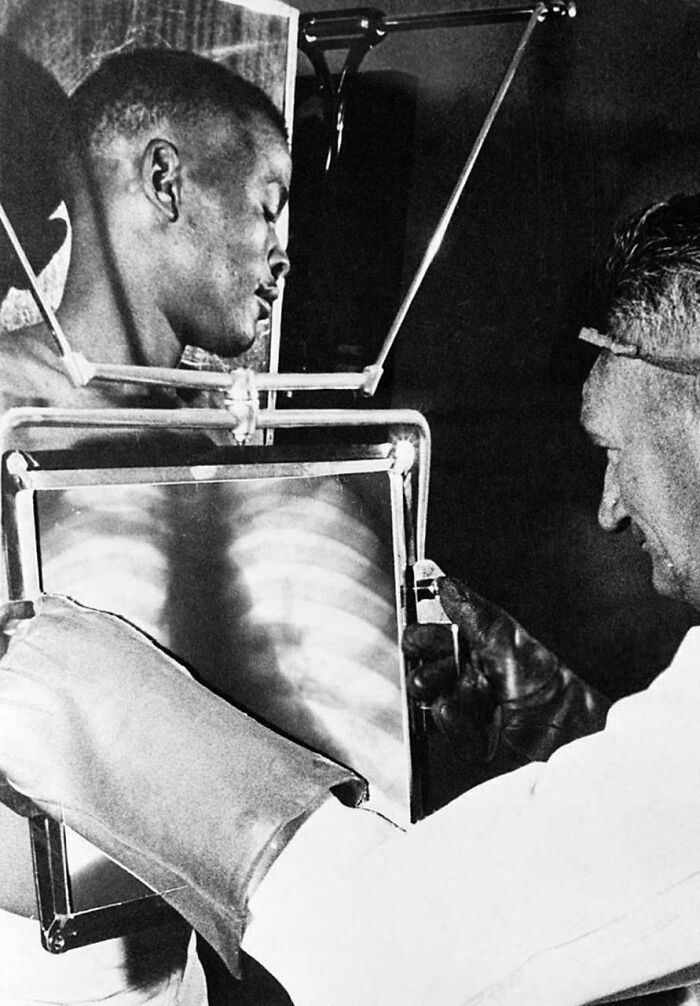 Learning If Miners Swallowed Diamonds Inside – X-ray Style, 1954