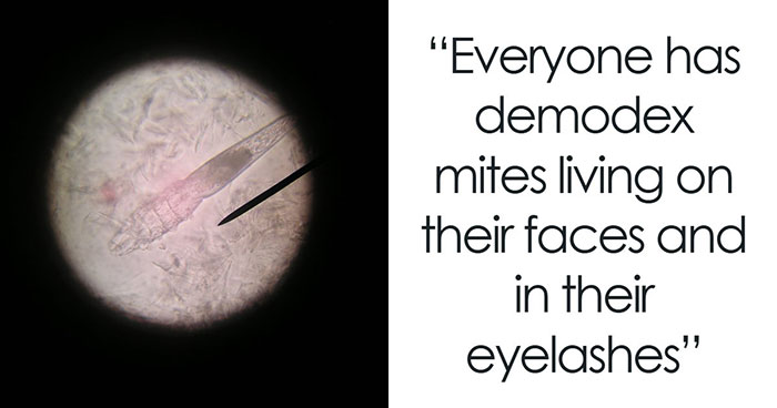 Brace Yourself: 50 WTF Facts That Are Actually True