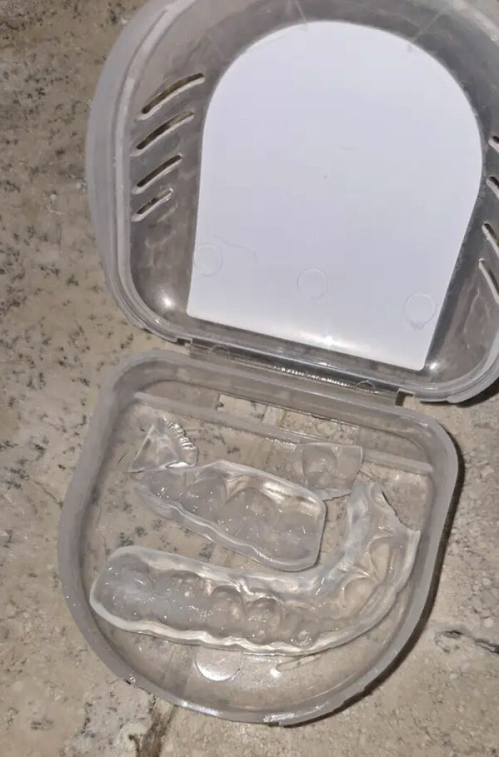 Spilled an $800 Mouth Guard off the Counter and It Shattered—Yikes!