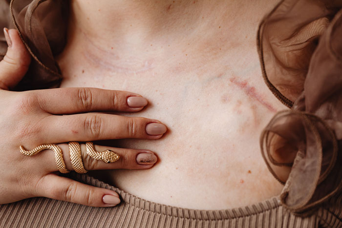 Hold Up, People Survived WHAT?! Wild Near-Death Stories You’ve Gotta Hear